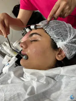 عکس فیشیال و پاکسازی اتاق پوست آزیتا، ولایت، شیراز 2